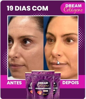 dream colágeno antes e depois a