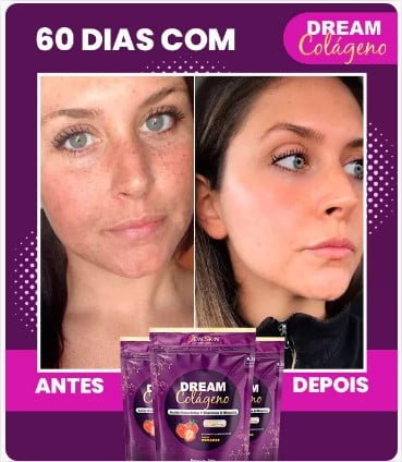 dream colágeno antes e depois b