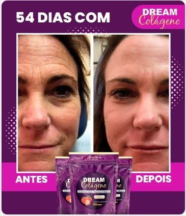 dream colágeno antes e depois c