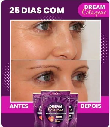 dream colágeno antes e depois d