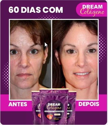 dream colágeno antes e depois e